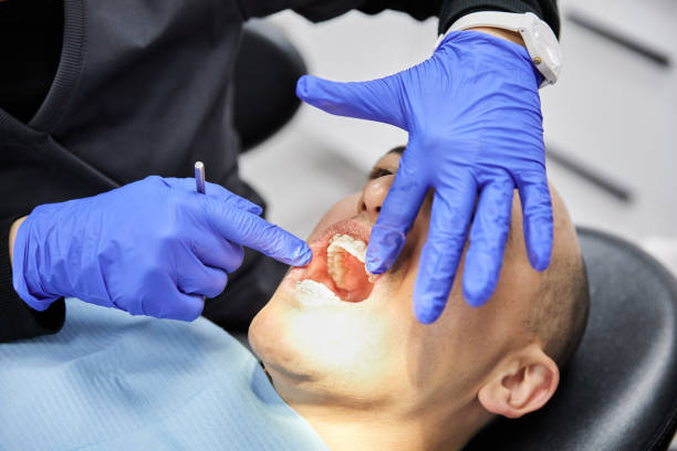Best Emergency Wisdom Teeth Removal in Honesdale, PA