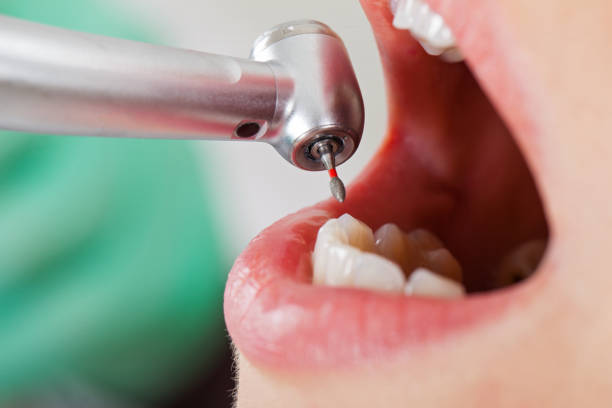 Best Emergency Broken Tooth Repair in Honesdale, PA